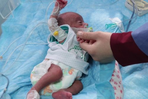 امکان بهبودی اگزمای پوستی نوزادان با افزایش سن